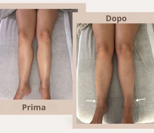 Lymph: the Great Forgotten Factor of the Silhouette